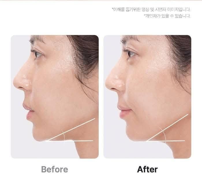 Medicube Age-R Booster Pro Comment fonctionne le dispositif viral avec TikTok ?