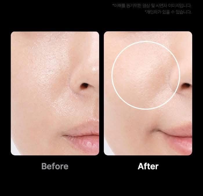 Medicube Age-R Booster Pro Comment fonctionne le dispositif viral avec TikTok ?