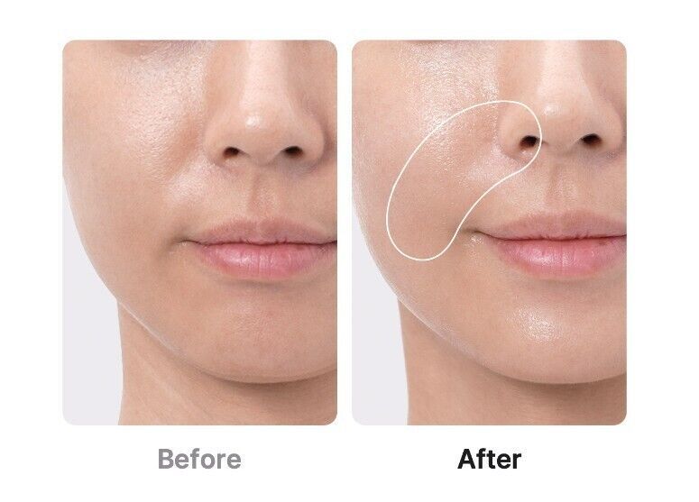 Medicube Age-R Booster Pro Comment fonctionne le dispositif viral avec TikTok ?