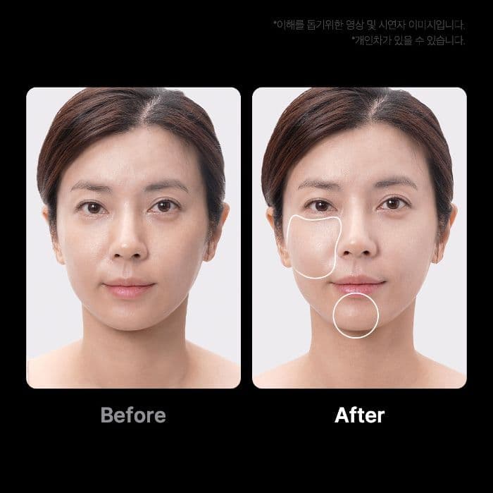 Medicube Age-R Booster Pro Comment fonctionne le dispositif viral avec TikTok ?