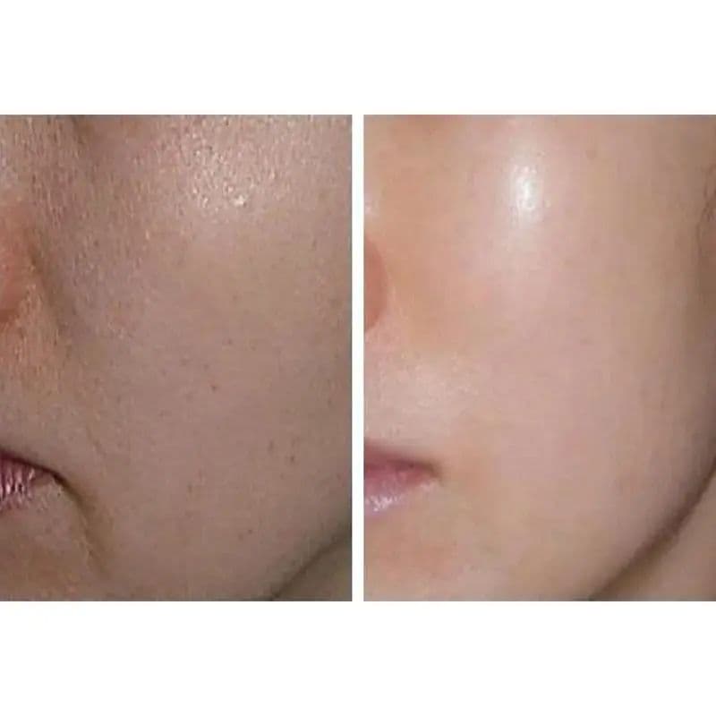 PDRN dans les soins de la peau: comment fonctionne un ingrédient innovant