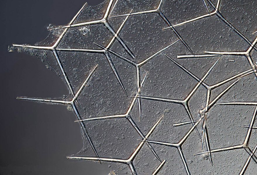 Spicules dans les cosmétiques : comment les micro-aiguilles contribuent à améliorer la peau