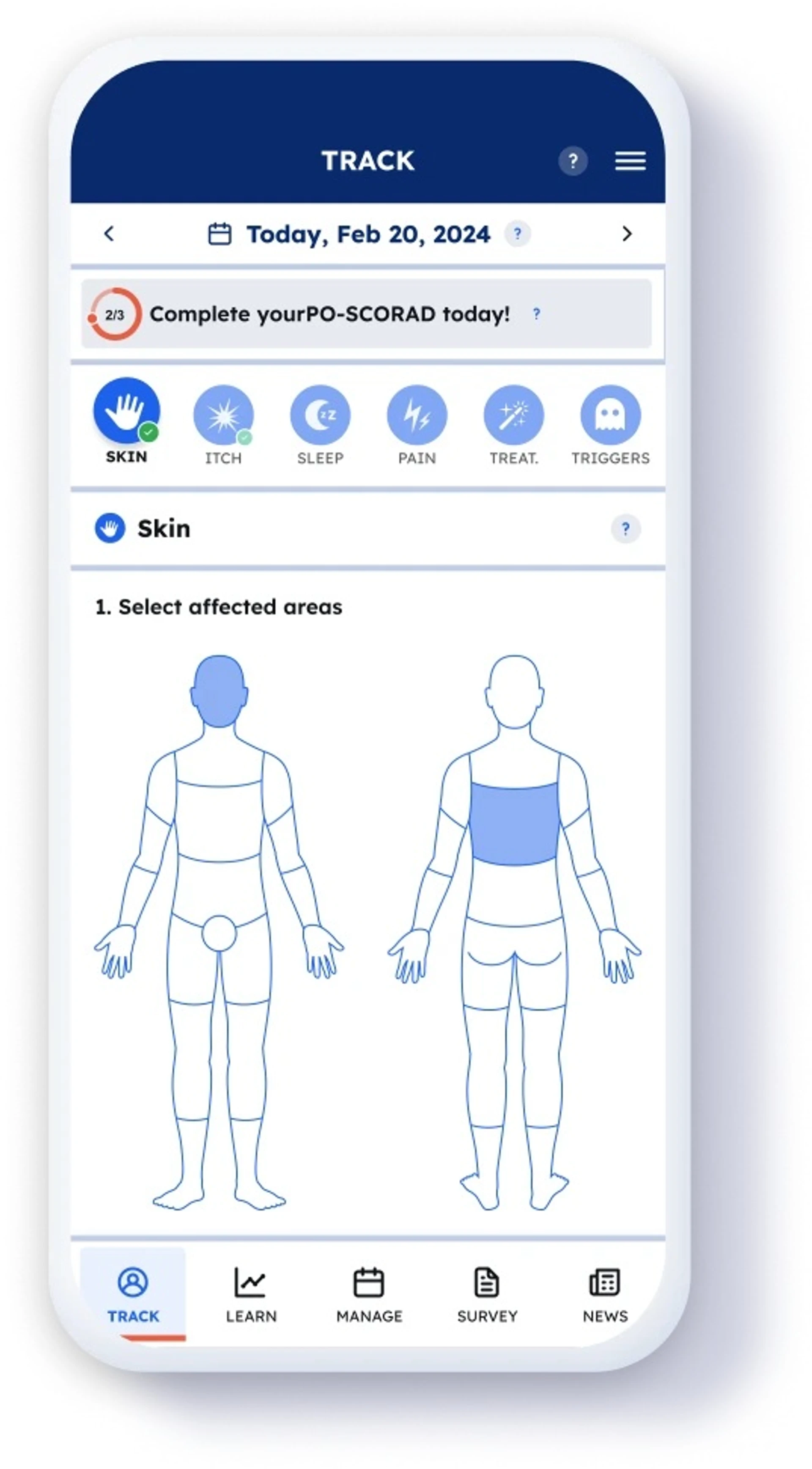 Approches alternatives pour le traitement de l’eczéma chronique des mains