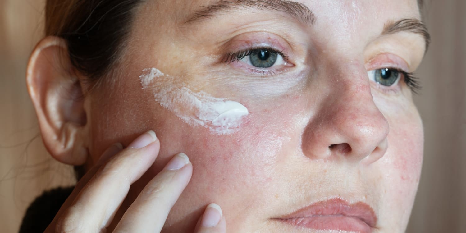 Peau grasse : comment la matifier avec de l’acide azélaïque ?