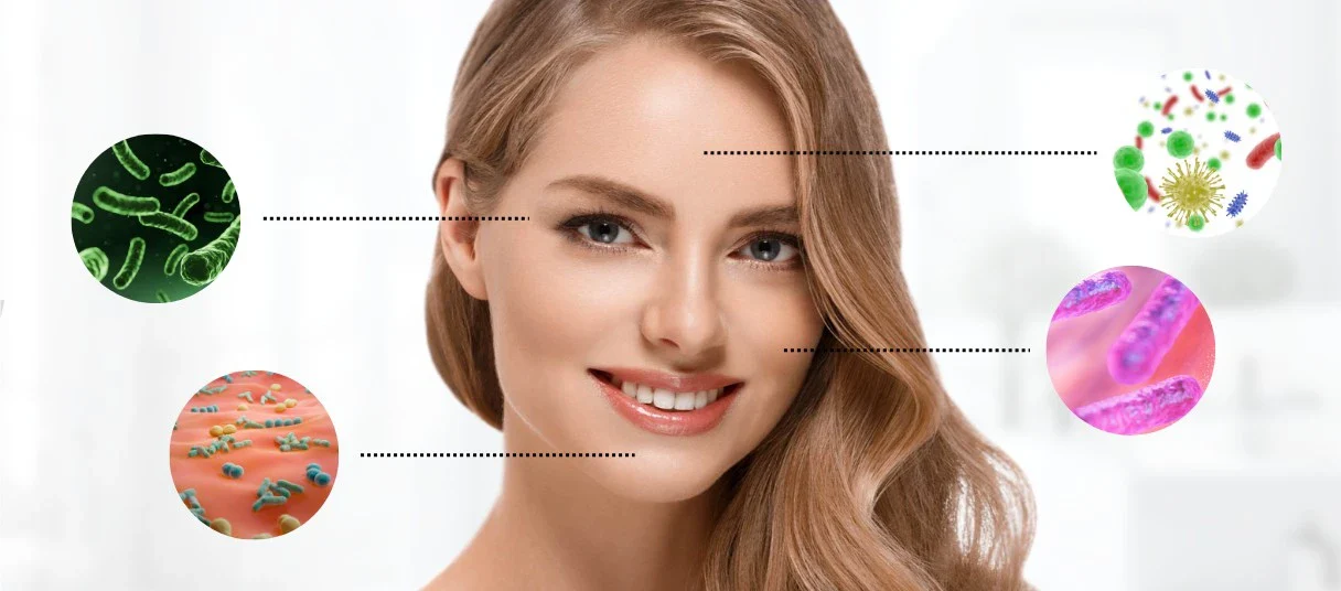 Avantages des probiotiques pour le traitement de la rosacée