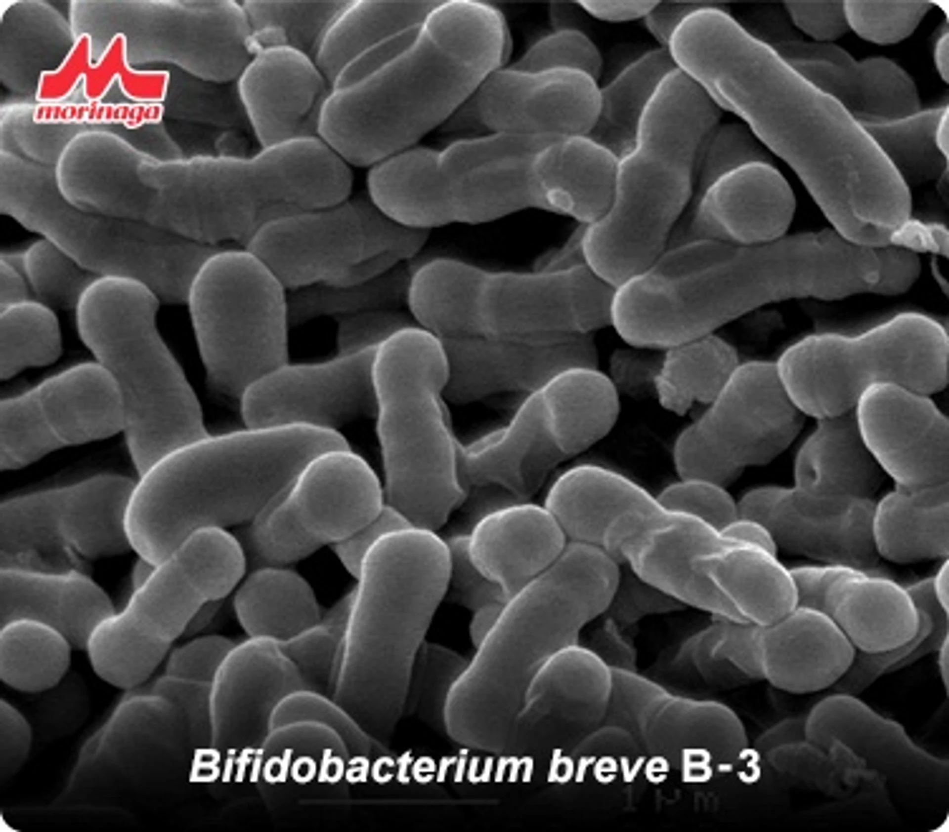 Avantages des probiotiques pour le traitement de la rosacée