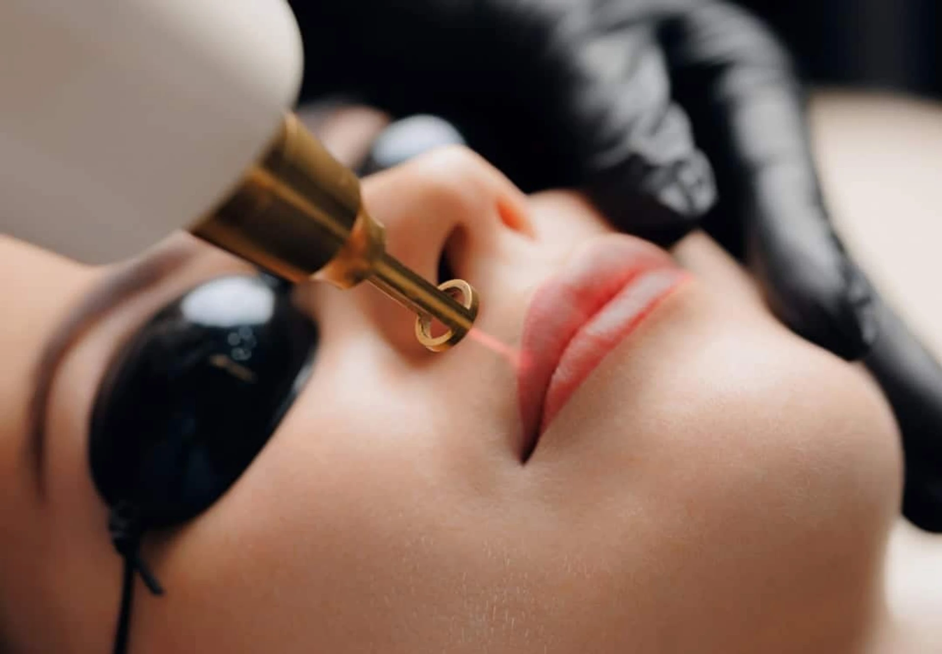 Causes de l’hyperpigmentation des lèvres et traitement des lèvres foncées